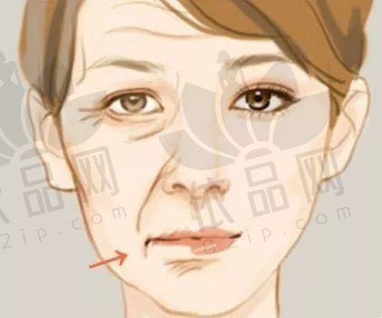 成都素美医院口碑怎么样？素美刘远程/李建钢做筋膜提升口碑评价超好