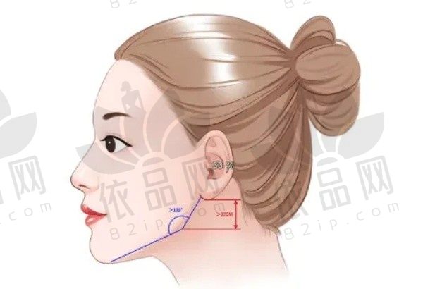 李志海磨骨是自然精致风格，磨骨手术做得好成功率高价格33900起