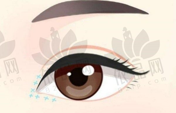 合肥华美哪个医生做眼睛好看？朱德刚/章圣/杨鹏/赵辑做眼睛口碑好