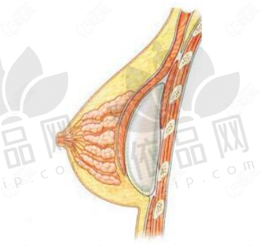 久盛假体价格表大全，属于国产中高端档次假体,来看看有必要做吗？
