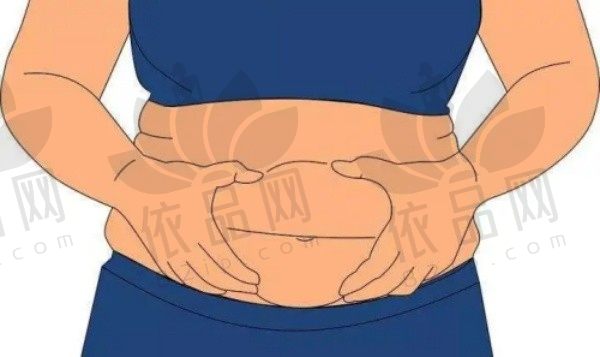 重庆罗海军吸脂好吗？独家体验:从术前设计到3个月恢复全记录