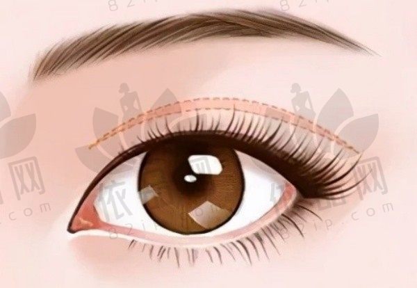 沈阳杏林做双眼皮医生名单推荐:张莹莹、房红超 、杜继凤双眼皮做的好