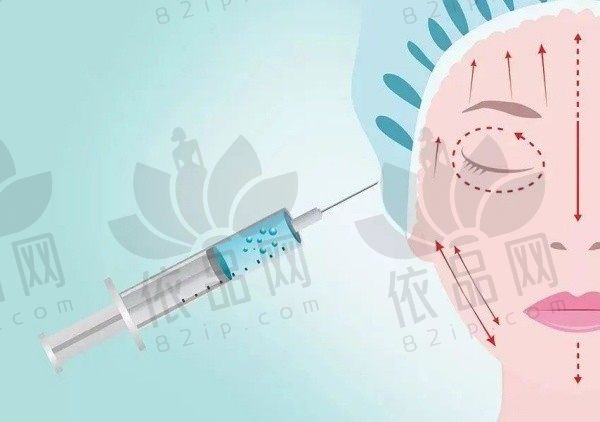 上海艺星郭敬松注射艾菲塑童颜针价格21800元起，手法娴熟成效自然