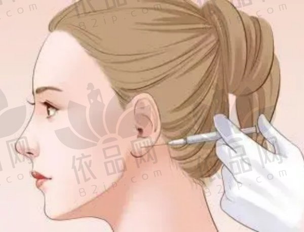 轮廓固定与面部年轻化的结合
