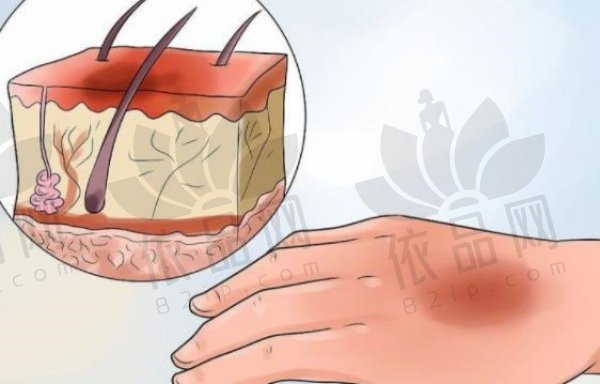 CGF打完能维持多久