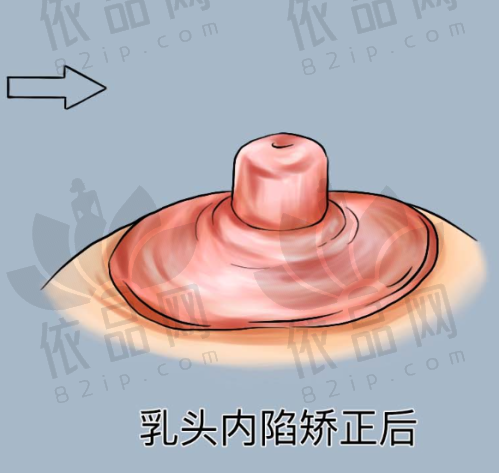 大同平城景然医疗美容诊所预约方式