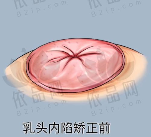 大同圣莲心医疗美容诊所收费价格表