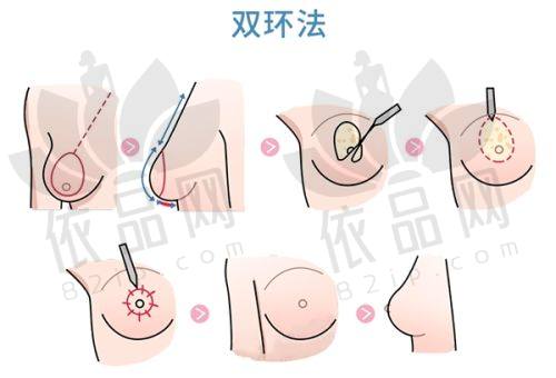 结语
