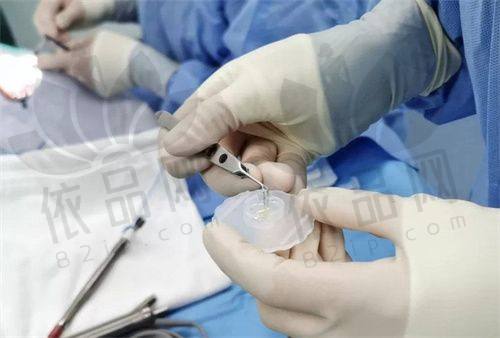 五、聊城爱尔眼科医院的价格情况