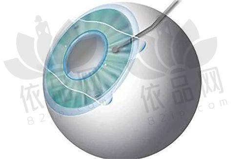 武汉佰视佳眼科门诊部交通路线
