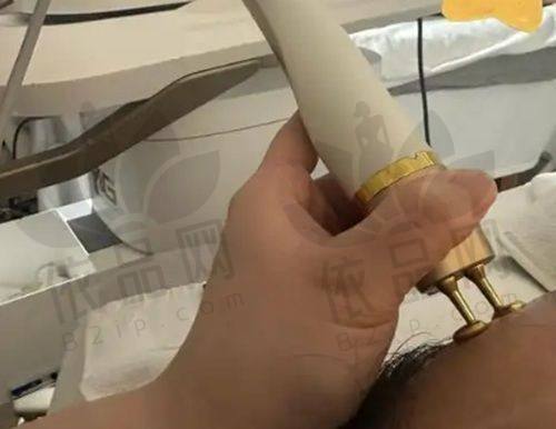 温州艺星的优势为手术保驾护航