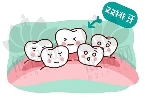 二、半口种植牙费用