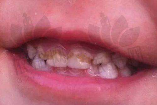 孙合佳医生 - 擅长项目