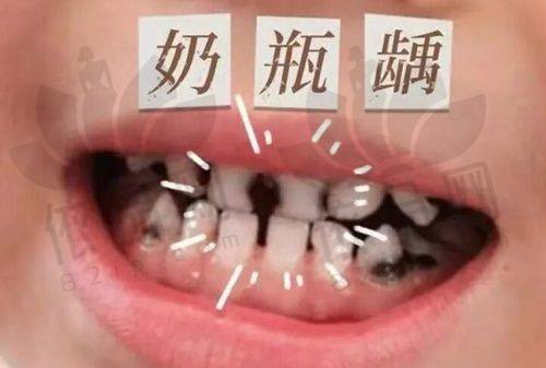 晋中百年中诺口腔诊所正规吗