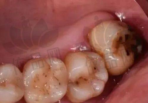 雅贝康口腔收费价格表