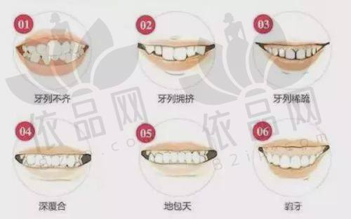 数字化种植技术的应用