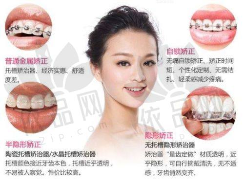 东莞固德口腔正畸中 心特色