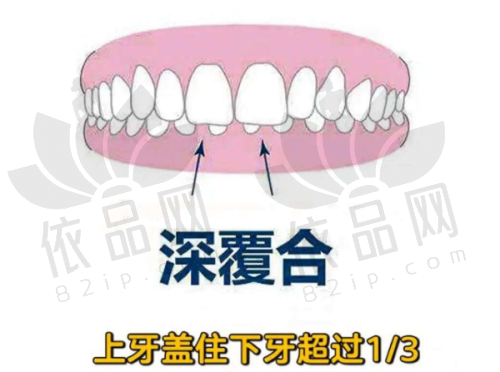 2025兰州海涛口腔医院根管治疗项目价目