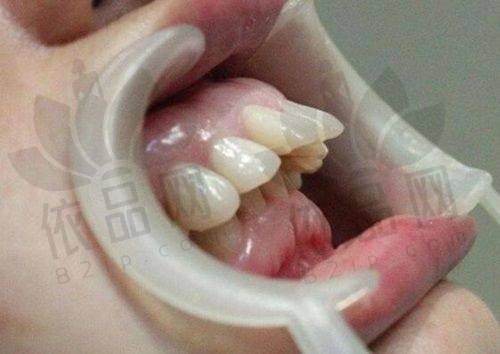 吕梁孝义爱牙口腔门诊部正规吗