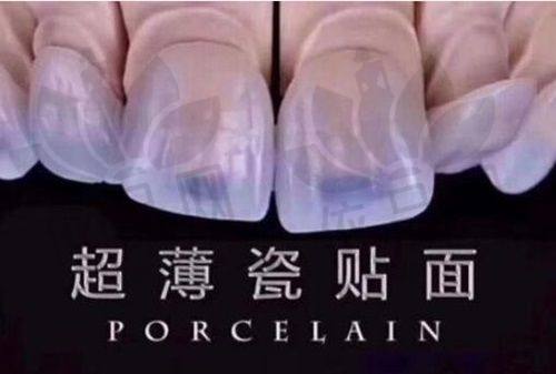 松山湖华为店：科技园区里的口腔护理好去处