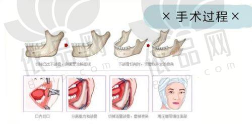 山西运城盈康一生医院整形科营业时间