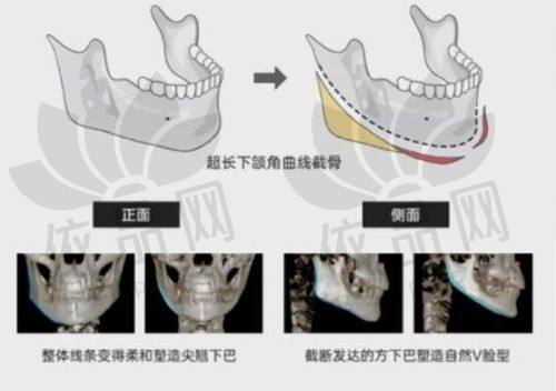 北京画美贾旭明医生——特色技术优势