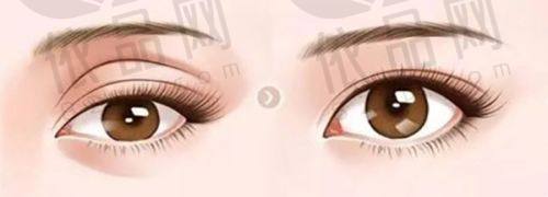 吕学璋——擅长项目