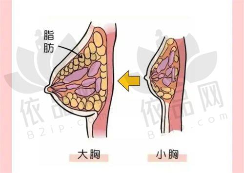 二、手术祛疤