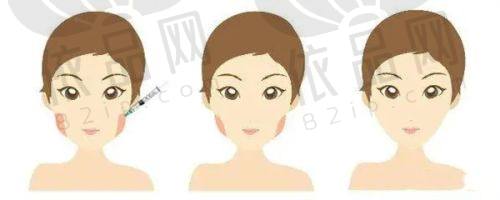 运城华美医疗美容门诊部正规吗