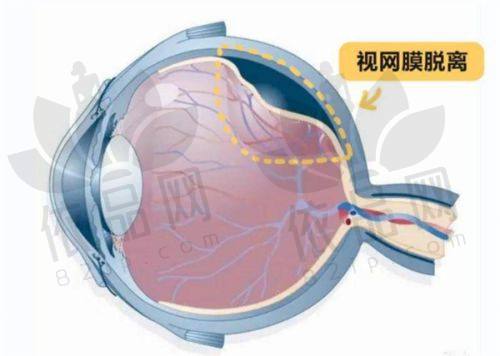 运城稷山段氏眼科医院：特色项目