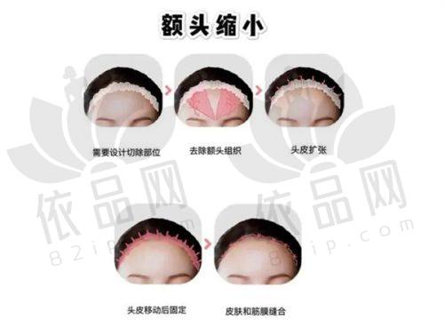 运城丽都医疗美容王新灿医生：医生擅长项目