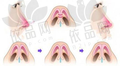 华美整形
