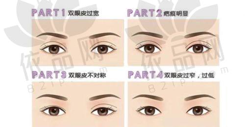 德州俏妃整形美容 | 眼部综合改善受认可，擅长修复类项目