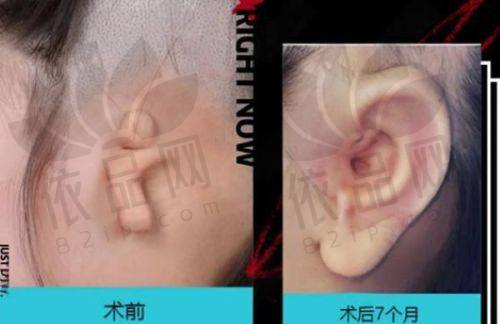 包头叶子整形美容医院收费价格表