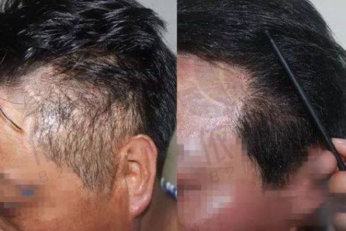 包头吴姝华美医疗美容医院植发科医生团队