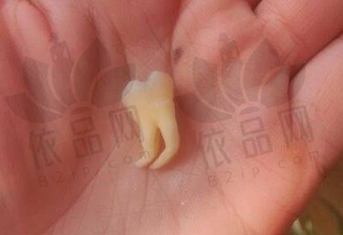 商丘京德口腔牙周治疗的优势