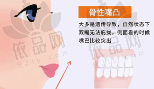 树脂补牙的过程