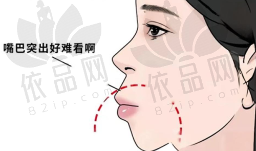 2025商丘京德口腔医院牙齿矫正收费标准