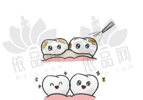 常州固德熊猫口腔树脂补牙200元起，美观耐磨，品质与性价比兼具！