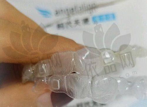 2025商丘京德口腔医院其他项目收费标准