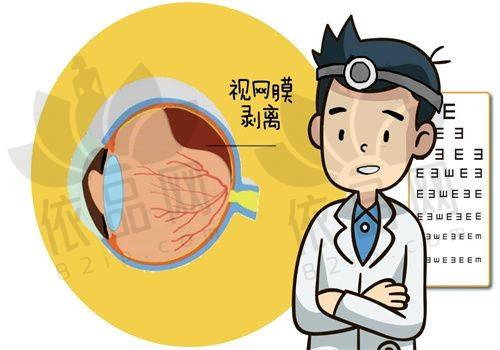 北京茗视光眼科全飞秒手术前后的感受与变化