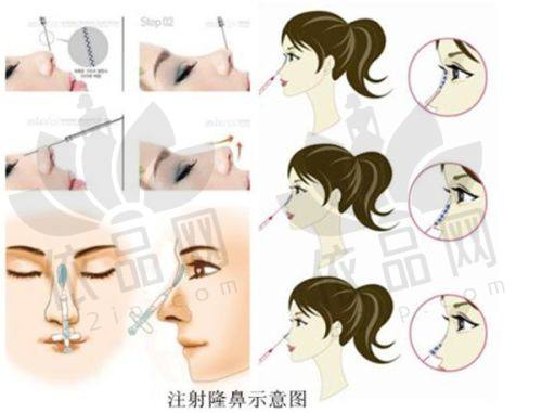 包头熙妍医疗美容门诊部正规吗