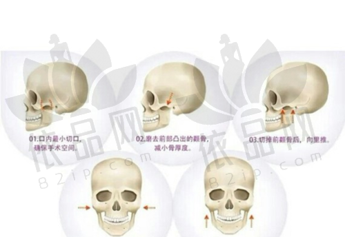 核心技术：专精不错，优势显著