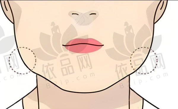 刘正茂磨骨什么风格？风格自然高级个性，技术多突破，案例见证实力