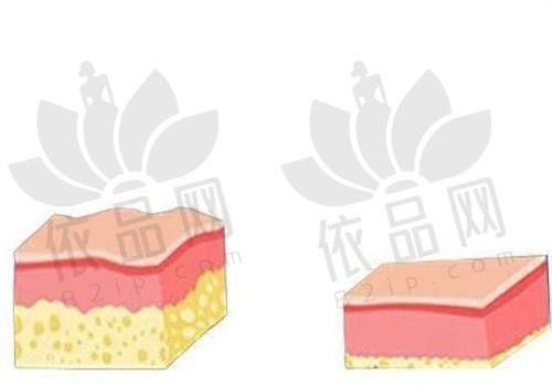 二、西安艺星医疗美容医院情况如何？