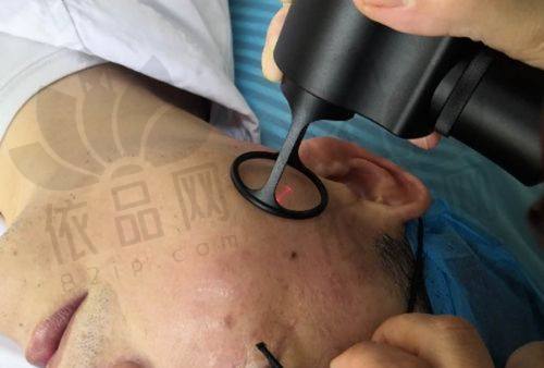 消除副乳需要注意什么？