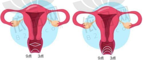 赤峰伊莲美人整形门诊部预约方式