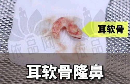 呼和浩特京美医疗美容医院正规吗