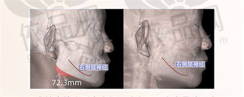 呼和浩特京美医疗美容王岩医生 - 擅长项目