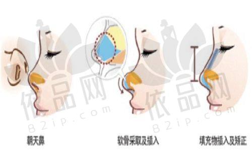 呼和浩特京美医疗美容医院收费价格表（参考）